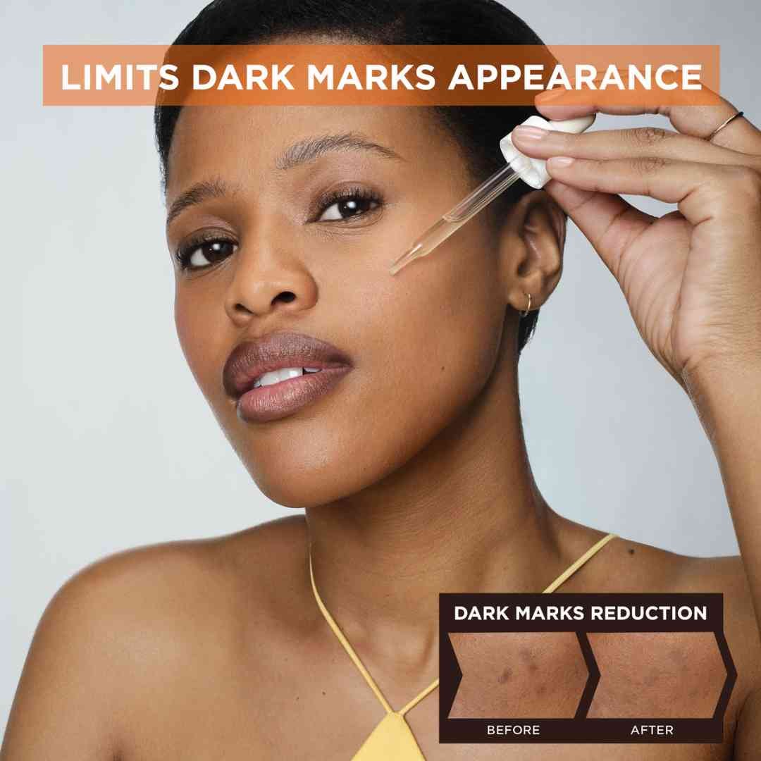reduces appearance of dark spots